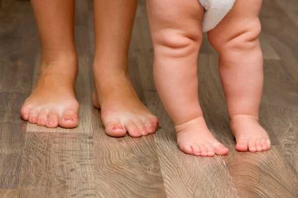 Παραμόρφωση Valgus σε παιδιά