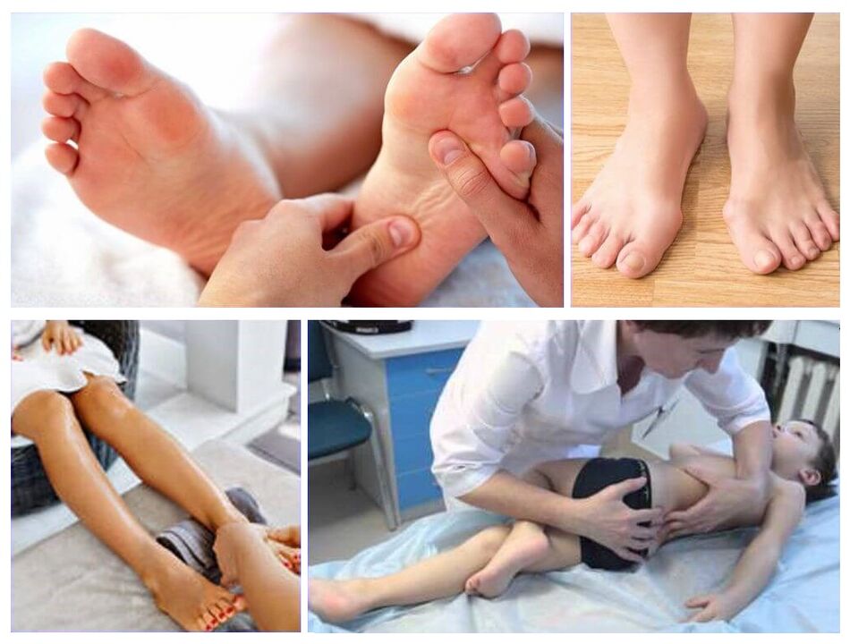 Παραμόρφωση Valgus στη θεραπεία των παιδιών