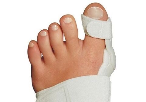Παραμόρφωση Valgus